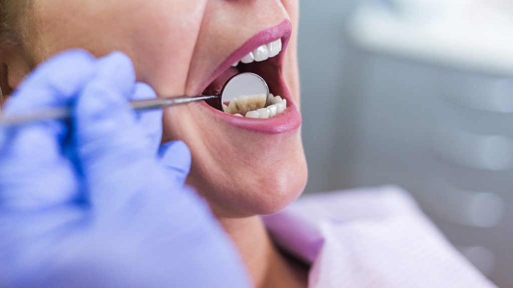 dentista especialista em canal bh